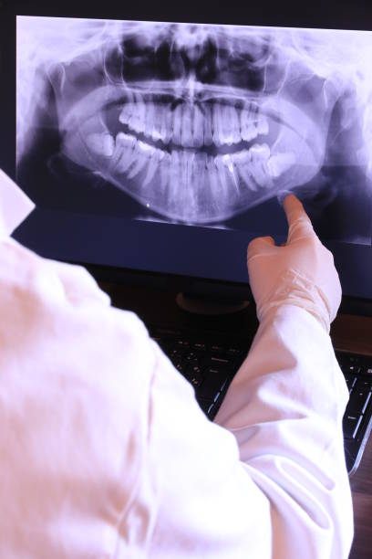 Best Emergency Dental Care for Broken or Chipped Teeth in Norris, TN